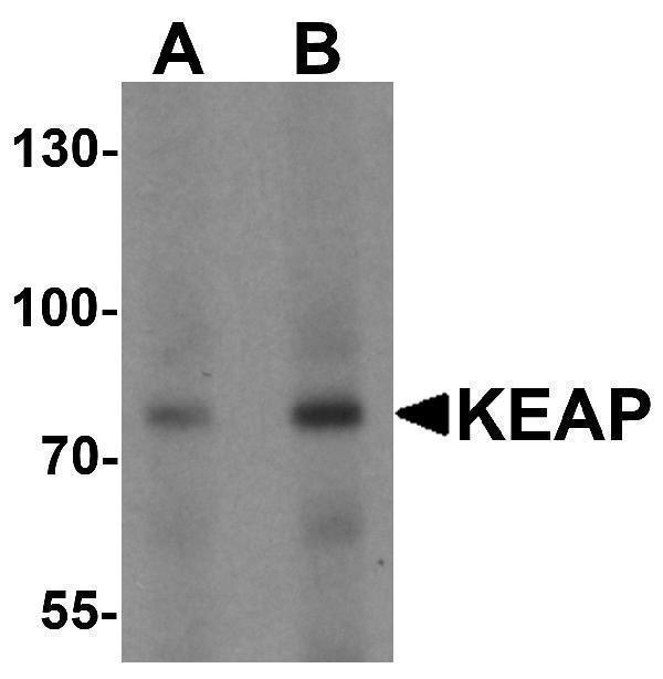 Western Blot Validation of KEAP1 in Human Lung 
Loading: 15 μg of lysates per lane