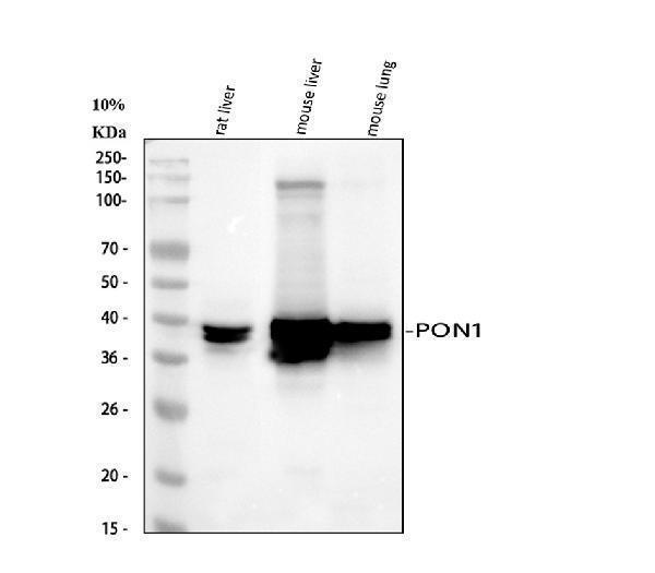  Western blot analysis of PON1 using anti-PON1 antibody (A00516)