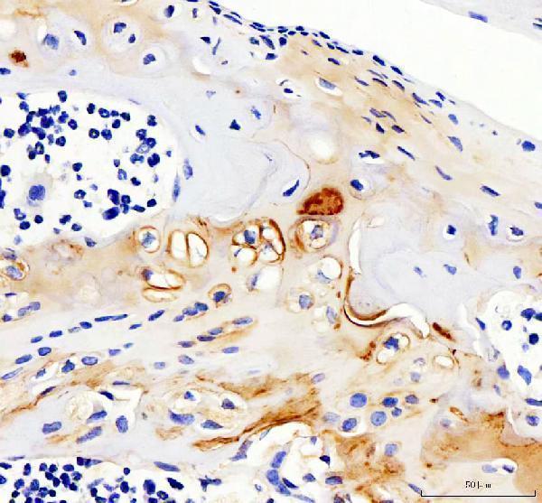  IHC analysis of Collagen Type II/COL2A1 using anti-Collagen Type II/COL2A1 antibody (A00517-2)
