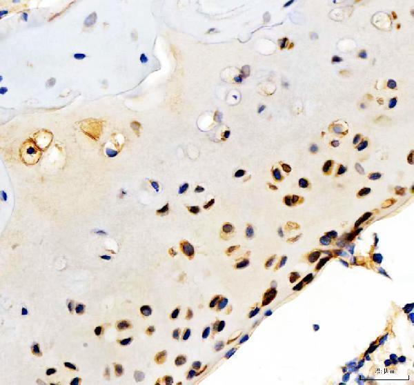  IHC analysis of Collagen Type II/COL2A1 using anti-Collagen Type II/COL2A1 antibody (A00517-2)