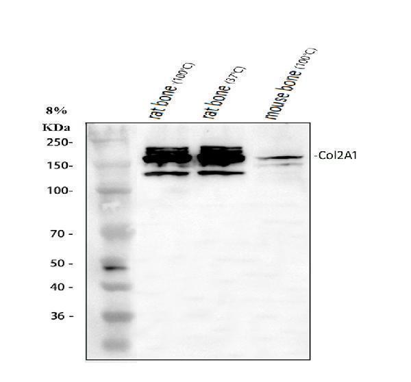  Western blot analysis of Collagen Type II/COL2A1 using anti-Collagen Type II/COL2A1 antibody (A00517-2)