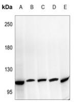 Western blot analysis of NOTCH2 expression in HEK293T (A), HepG2 (B), H1792 (C), H9C2 (D), AML12 (E) whole cell lysates