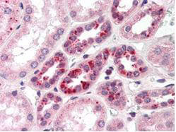 a00518 notch2 primary antibodies ihc testing 1