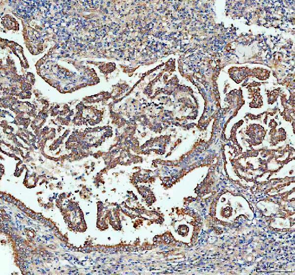 a00519 sacsin primary antibodies ihc testing 1