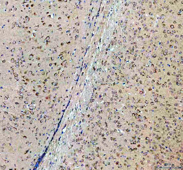 a00519 sacsin primary antibodies ihc testing 2