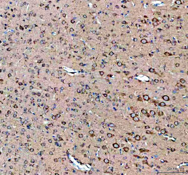 a00519 sacsin primary antibodies ihc testing 3
