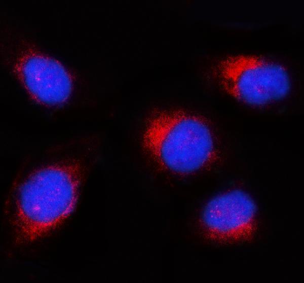 IF analysis of AKT3 using anti-AKT3 antibody (PA2260)