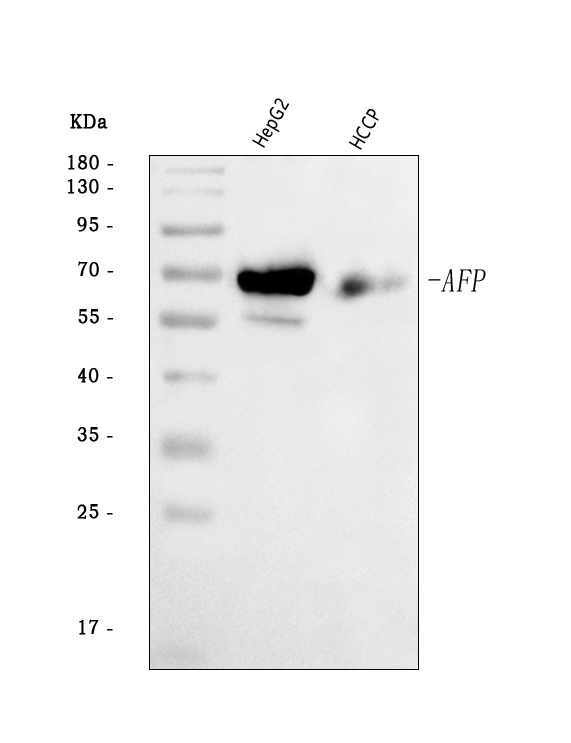  Western blot analysis of alpha 1 Fetoprotein/AFP using anti-alpha 1 Fetoprotein/AFP antibody (A00522-3)
