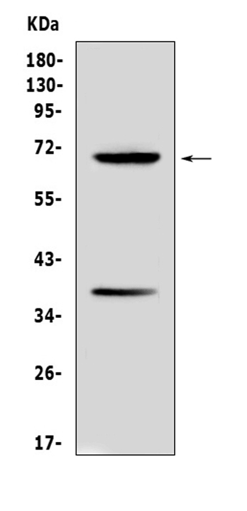 https://www.bosterbio.com/media/catalog/product/a/0/a00522-alpha_1_fetoprotein-primary-antibodies-wb-testing-1_1.jpg