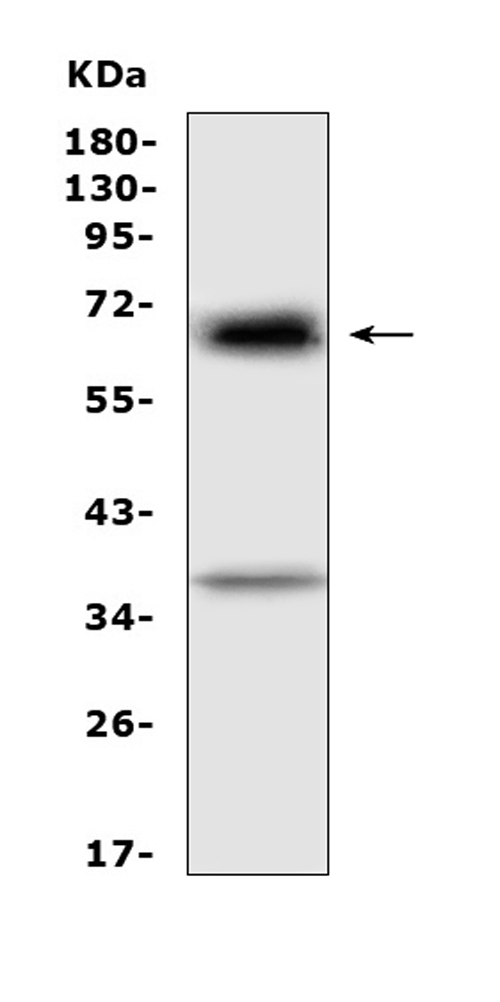Western blot analysis of Alpha 1 Fetoprotein using anti-Alpha 1 Fetoprotein antibody (A00522). Electrophoresis was performed on a 5-20% SDS-PAGE gel at 70V (Stacking gel) / 90V (Resolving gel) for 2-3 hours. The sample well of each lane was loaded with 50ug of sample under reducing conditions. Lane 1: rat RH35 whole cell lysates. After Electrophoresis, proteins were transferred to a Nitrocellulose membrane at 150mA for 50-90 minutes. Blocked the membrane with 5% Non-fat Milk/ TBS for 1.5 hour at RT. The membrane was incubated with rabbit anti-Alpha 1 Fetoprotein antigen affinity purified polyclonal antibody (Catalog # A00522) at 0.5 μg/mL overnight at 4°C, then washed with TBS-0.1%Tween 3 times with 5 minutes each and probed with a goat anti-rabbit IgG-HRP secondary antibody at a dilution of 1:10000 for 1.5 hour at RT. The signal is developed using an Enhanced Chemiluminescent detection (ECL) kit (Catalog # EK1002) with Tanon 5200 system. A specific band was detected for Alpha 1 Fetoprotein at approximately 69KD. The expected band size for Alpha 1 Fetoprotein is at 69KD.