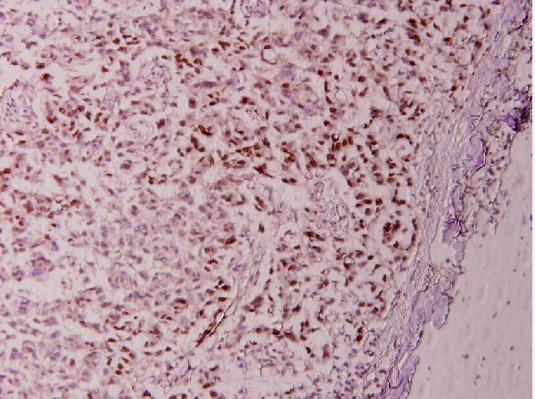 a00523 1 stat6 primary antiboties ihc testing 2