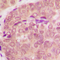 a00523 2 stat6 primary antiboties ihc testing 2