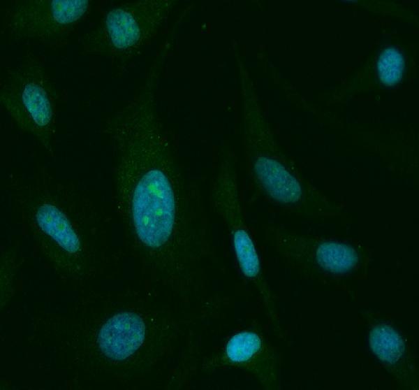 a00523 4 stat6 primary antibodies if testing 6