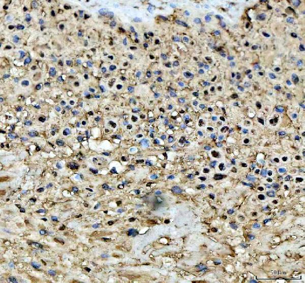  IHC analysis of STAT6 using anti-STAT6 antibody (A00523-4)