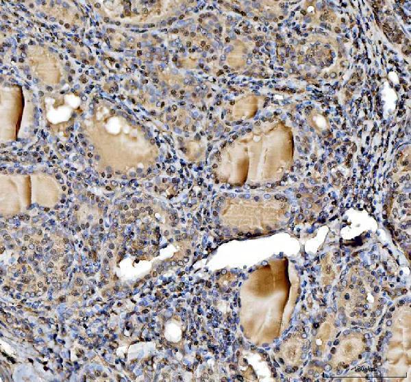  IHC analysis of STAT6 using anti-STAT6 antibody (A00523-4)