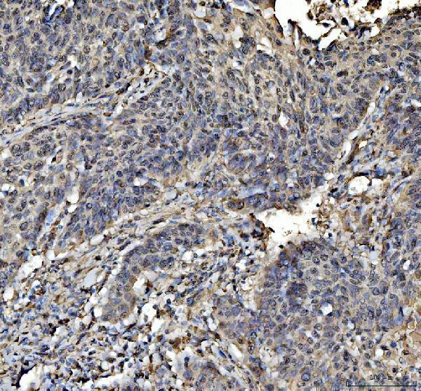 a00523 4 stat6 primary antibodies ihc testing 4
