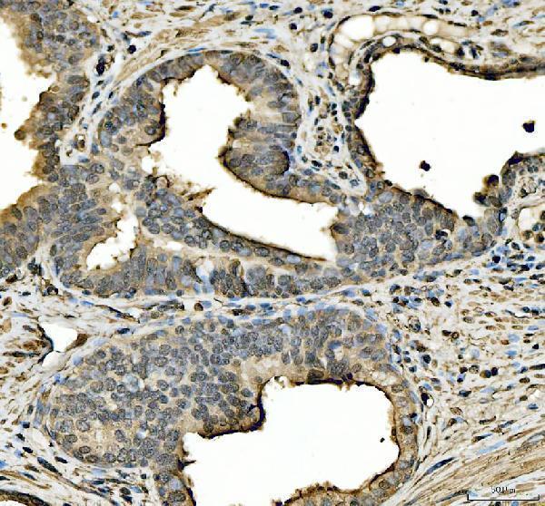 a00523 4 stat6 primary antibodies ihc testing 5
