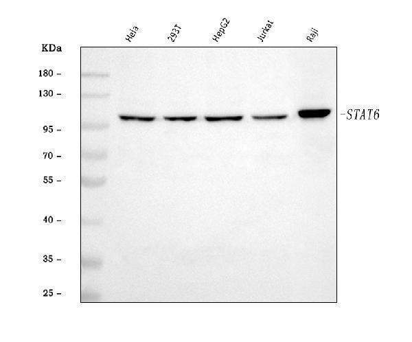  Western blot analysis of STAT6 using anti-STAT6 antibody (A00523-4)