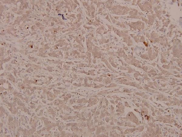 a00523y641 stat6 primary antiboties ihc testing 2