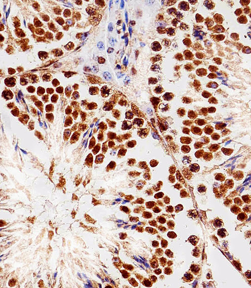 a00524 1 anti rbx1 antibody c term ihc p testing 6