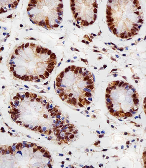 a00524 1 anti rbx1 antibody c term ihc p testing 7