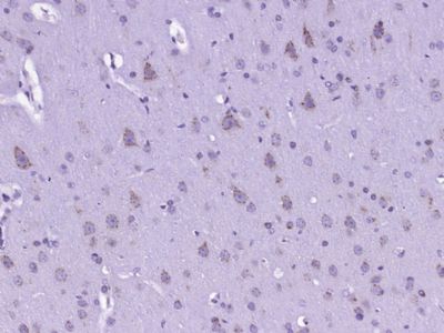 a00525 1 nlrc4 primary antiboties ihc testing 1