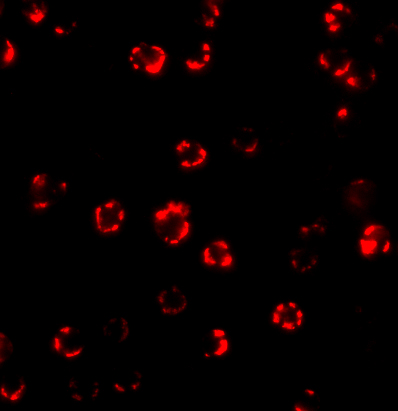 Immunofluorescence of ATG16 in Hela cells with ATG16 antibody at 4 μg/mL
