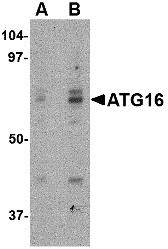 Western blot analysis of ATG16 in HeLa cell lysate with ATG16 antibody at (A) 0