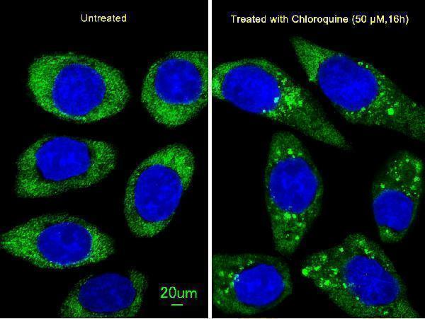 a00526 2 anti atg16l antibody if testing 1