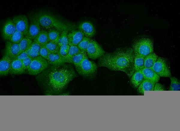 a00526 3 atg16l1 primary antibodies if testing 5