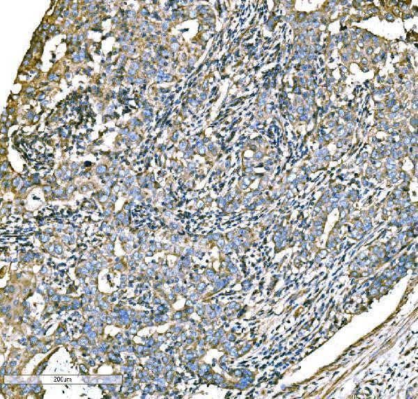  IHC analysis of ATG16L1 using anti-ATG16L1 antibody (A00526-3)
