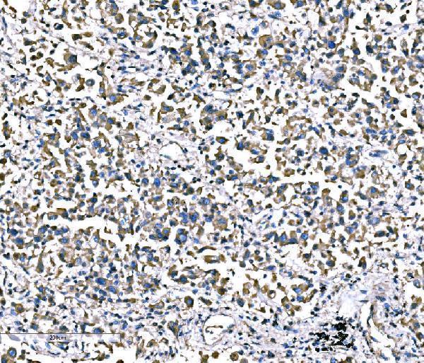  IHC analysis of ATG16L1 using anti-ATG16L1 antibody (A00526-3)