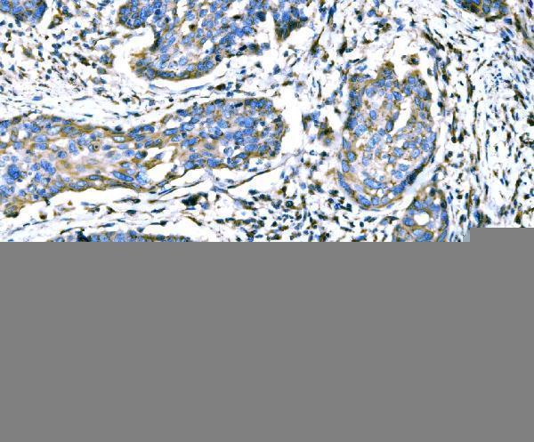 a00526 3 atg16l1 primary antibodies ihc testing 4