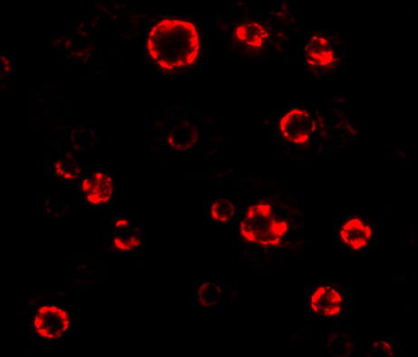 Immunofluorescence of ATG16 in Hela cells with ATG16 antibody at 4