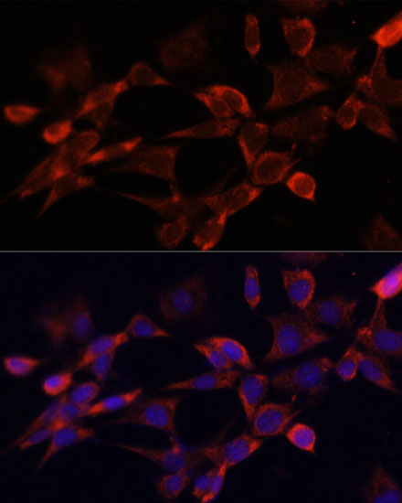 Immunohistochemistry of paraffin-embedded mouse uterus using GLI1 Rabbit pAb  at dilution of 1:150 