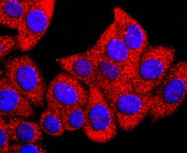 ICC staining Gli1 in HepG2 cells (red)