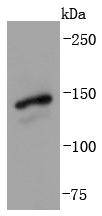 Western blot analysis of Gli1 on SH-SY-5Y cells lysates using anti-Gli1 antibody at 1/1,000 dilution