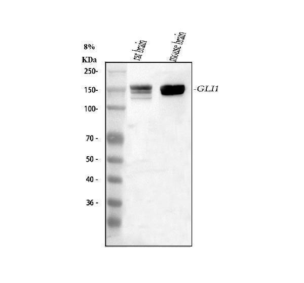  Western blot analysis of GLI1 using anti-GLI1 antibody (A00527-3)