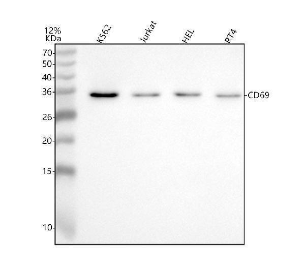  Western blot analysis of CD69 using anti-CD69 antibody (A00529-3)