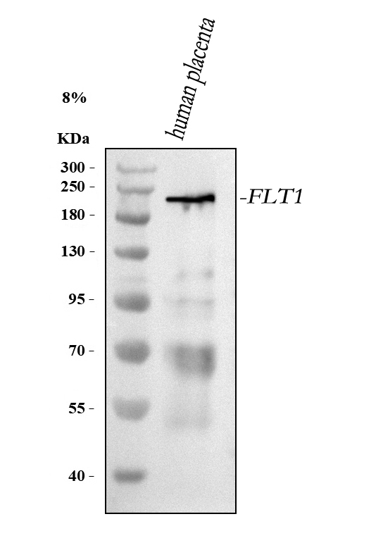  Western blot analysis of VEGFR-1/FLT1 using anti-VEGFR-1/FLT1 antibody (A00534-5)