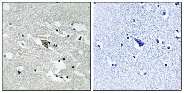 Immunohistochemistry analysis of paraffin-embedded human brain, using VEGFR1 (Phospho-Tyr1048) Antibody