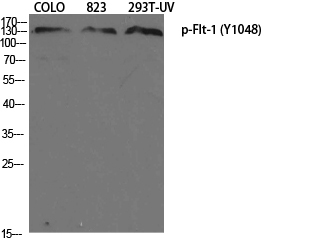 Western Blot analysis of various cells using Phospho-Flt-1 (Y1048) Polyclonal Antibody diluted at 1:1000