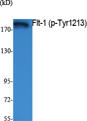 Western Blot analysis of extracts from K562 cells, using Phospho-Flt-1 (Y1213) Polyclonal Antibody