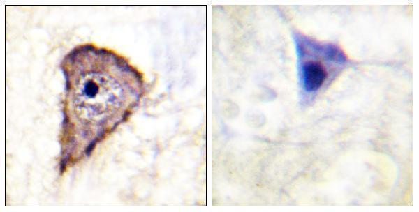 Immunohistochemistry analysis of paraffin-embedded human brain, using VEGFR1 (Phospho-Tyr1333) Antibody