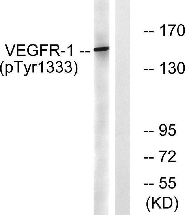 Western blot analysis of lysates from K562 cells treated with etoposide 25uM 24h, using VEGFR1 (Phospho-Tyr1333) Antibody