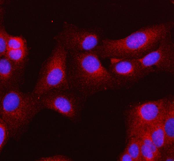 a00535 3 mlkl primary antibodies if testing 8