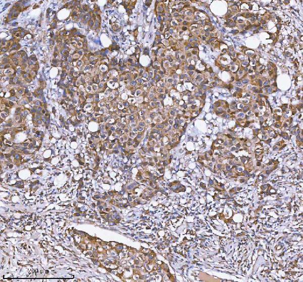  IHC analysis of MLKL using anti-MLKL antibody (A00535-3)