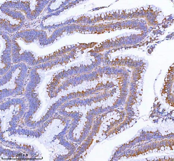 a00535 3 mlkl primary antibodies ihc testing 4