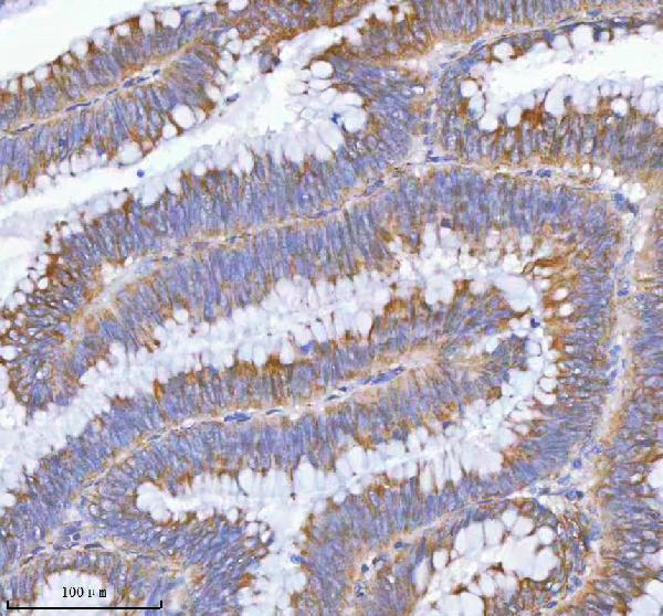 a00535 3 mlkl primary antibodies ihc testing 5
