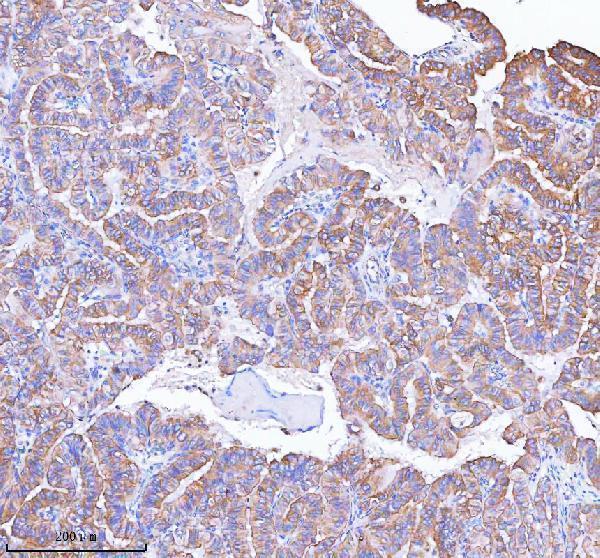 a00535 3 mlkl primary antibodies ihc testing 6